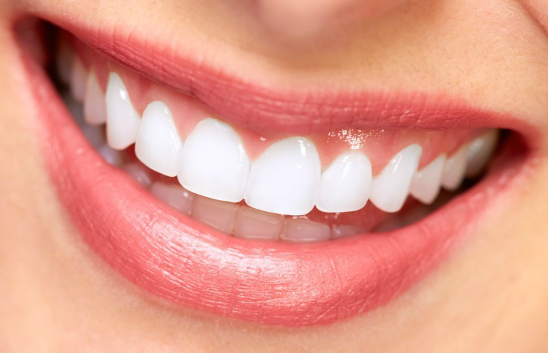 Take Advantage of Great Teeth Whitening in Wrigleyville